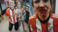 Fanouek Boca Juniors zbil fanynku River Plate